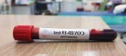 حفلات كورونا ترصد مكافئة لأول شخص يصاب بالفيروس