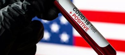 شفاء مليون و280 ألفا من فيروس كورونا في الولايات المتحدة والإصابات الجديدة تتراجع